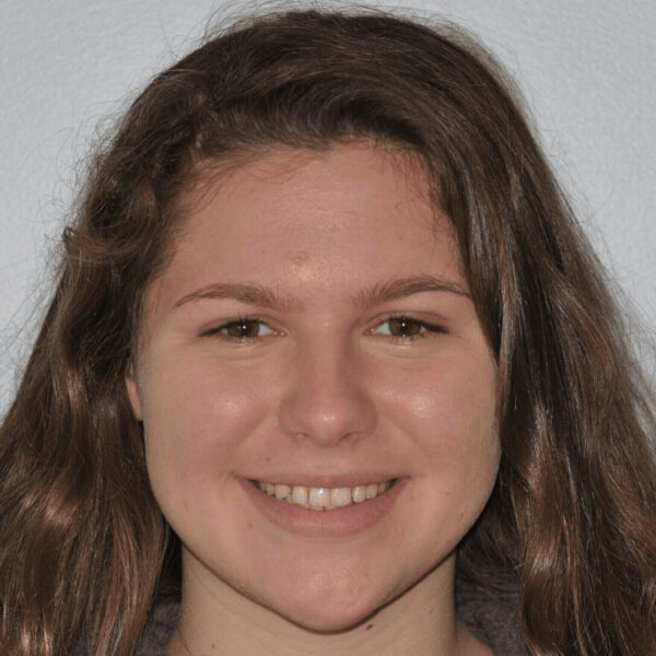 Glass-ortho-before-after-10 Teen orthodontic patient smiling before braces treatment at glass orthodontics in elizabeth city, nc